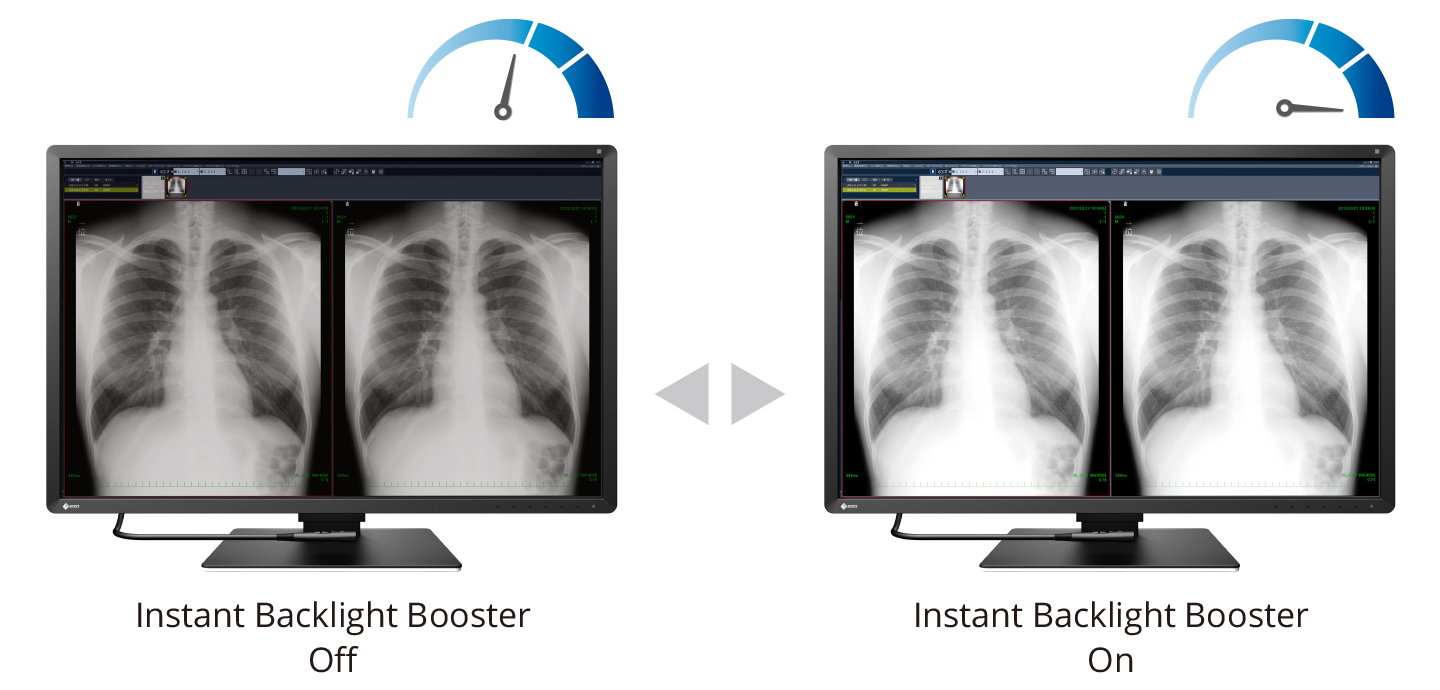 Boost Images for Easy Viewing 